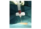 Busse - Bone Marrow Biopsy / Aspiration Needles