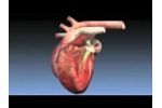 MitralSeal Canine Mitral Valve Replacement Technology - Video