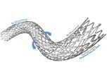 Peripheral Vascular Self-Expanding Stent System