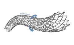 Tsunamed - Model NAVALIS-pp ADVANCE - Peripheral Vascular Self-Expanding Stent System