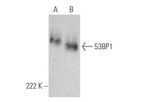 Santa Cruz - Model 53BP1 -(E-10): sc-515841 - Mouse Monoclonal Antibodies