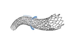 Stron - Model POLARIS-pp ADVANCE - Peripheral Vascular Self-Expanding Stent System