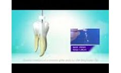 What is the advantages of MPro root canal files and how to use it - Video