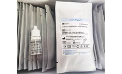 SARS-CoV-2 Antibody Fast Test Kit