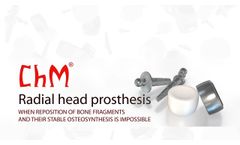 ChM Radial Head Prosthesis - Video