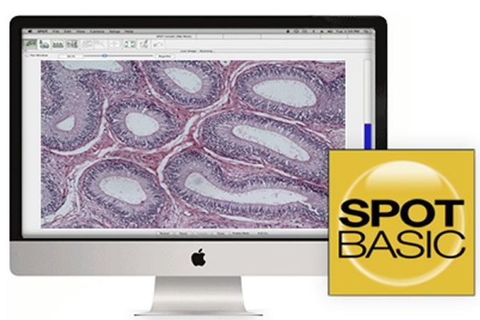SPOT Basic - Image Capture Software By SPOT Imaging, A Division Of ...