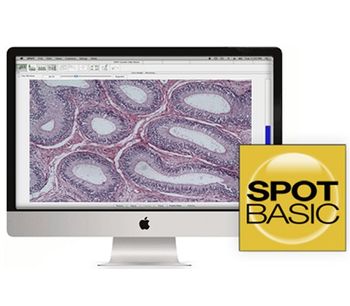 SPOT Basic - Image Capture Software By SPOT Imaging, A Division Of ...