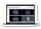 Brainbox - Model k-Plan - Ultrasound Therapy Planning System