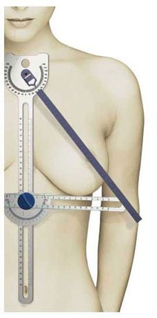 Becon - Model Brecise - Precision Measuring System for Surgical Breast Procedures