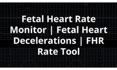 Fetal Heart Rate Monitor | Fetal Heart Decelerations | FHR Rate Tool - Video