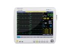 Avante Waveline Pro - Model 66009B2VMRS - Veterinary Vital Signs Monitor