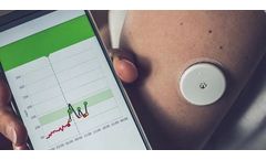 Medical Wearable Devices and Sensors