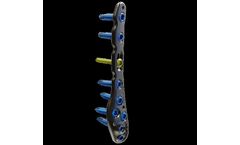 Model Winsta-Fit - Locking Plate System for The Distal Fibula and Tibia