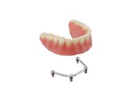 Dental implants Prothetics
