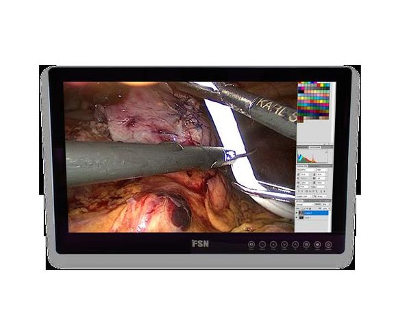 Model FS-E2101DT 21.5 inch - Touch Medical Grade Monitor