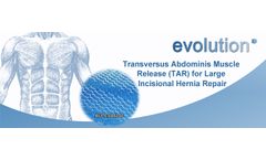 Tar-Transversus Abdominis Muscle Release