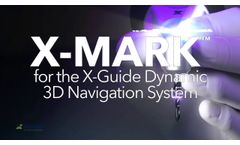 Introducing X-MARK Virtual Registration for X-Guide Dynamic 3D Navigated Implant Surgery - Video