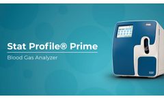 StatProfile Prime Blood Gas Analyzer from Nova Biomedical | TECOM Analytical Systems - Video