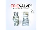 TRICVALVE® - Transcatheter Bicaval Valves System