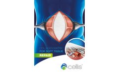 CELLIS - Collagen Matrix for Soft Tissue Repair Datasheet