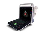 SONOSIF - Model CD-UL1 - Color Doppler Laptop Convex Diagnostic Ultrasound Scanner