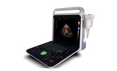 SONOSIF - Model CD-UL1 - Color Doppler Laptop Convex Diagnostic Ultrasound Scanner