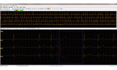 Version 6.0e. - HE/LX® (Holter) Analysis Software