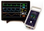 Vmed - Model VetTab - Wireless Patient Monitor