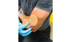 Model IontoPatch - Pain-Free, Non-Invasive Drug Delivery Device