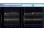 Optical Coherence Tomography Angiography Software