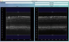 Optical Coherence Tomography Angiography Software