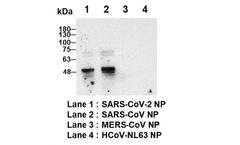 Croyez - Human Anti-SARS-CoV & CoV-2 NP Antibody (IgG)