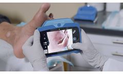 Standard Imaging of wounds with the MolecuLightDX - Video