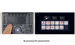 SonoScape A6V Expert - Video