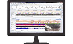 NeuroScore - CNS Data Analysis Software
