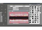Owandy Radiology - Version Quickvision - Comprehensive Dental Imagery Software Solution