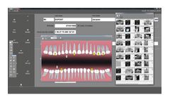 Owandy Radiology - Version Quickvision - Comprehensive Dental Imagery Software Solution