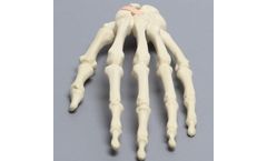 Sawbones - Model 1016-18 - Hand with Scaphoid Fracture and Ligament, Solid Foam