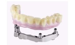 Panthera - Model Diamart - Two-part Implant Bridge