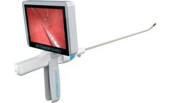 Endosee Advance - Direct Visualization System for Diagnostic and Therapeutic Procedures