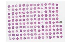 TriStar - Model TA3127 - IO Multi tumor array 4 of a set of 6 TMAs: CRC, Gastric ADC, Pancreatic ADC, Cholangiocarcinoma, GEJ with histopath data