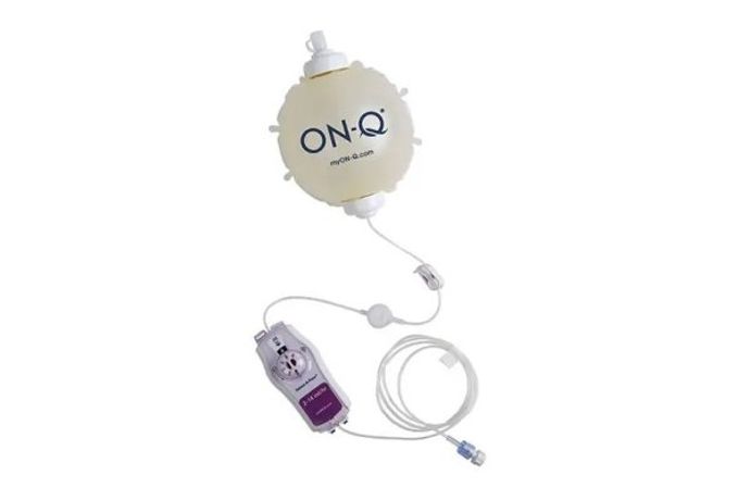 Avanos ON-Q - Pain Relief System