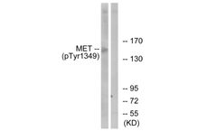 Model pTyr1349 - Anti-c-Met Antibody