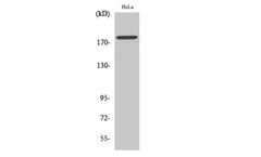 Model pTyr877 - Anti-HER2 Antibody