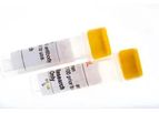 CoaChrom - Model A1AT-EIA - Capture and Detecting Antibodies Test Kits for ELISA