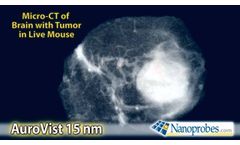 Micro-CT of Live Mouse: Brain Tumor after i.v. injection of AuroVist 15 nm X-ray Contrast Agent - Video