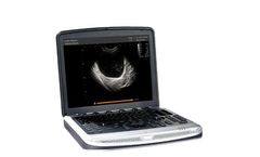 Universal - Model SB NINE - Portable Veterinary Ultrasound System