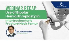 Use of Bipolar Hemiarthroscopy in intertrochanteric Fracture Neck Femur by Dr Rutul Gandhi (Surgeon) - Video