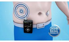 Medtronic MiniMed - How does the MiniMed 640G insulin pump work? - Video