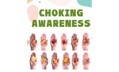 Stay Safe Every Day: Child Choking Insights